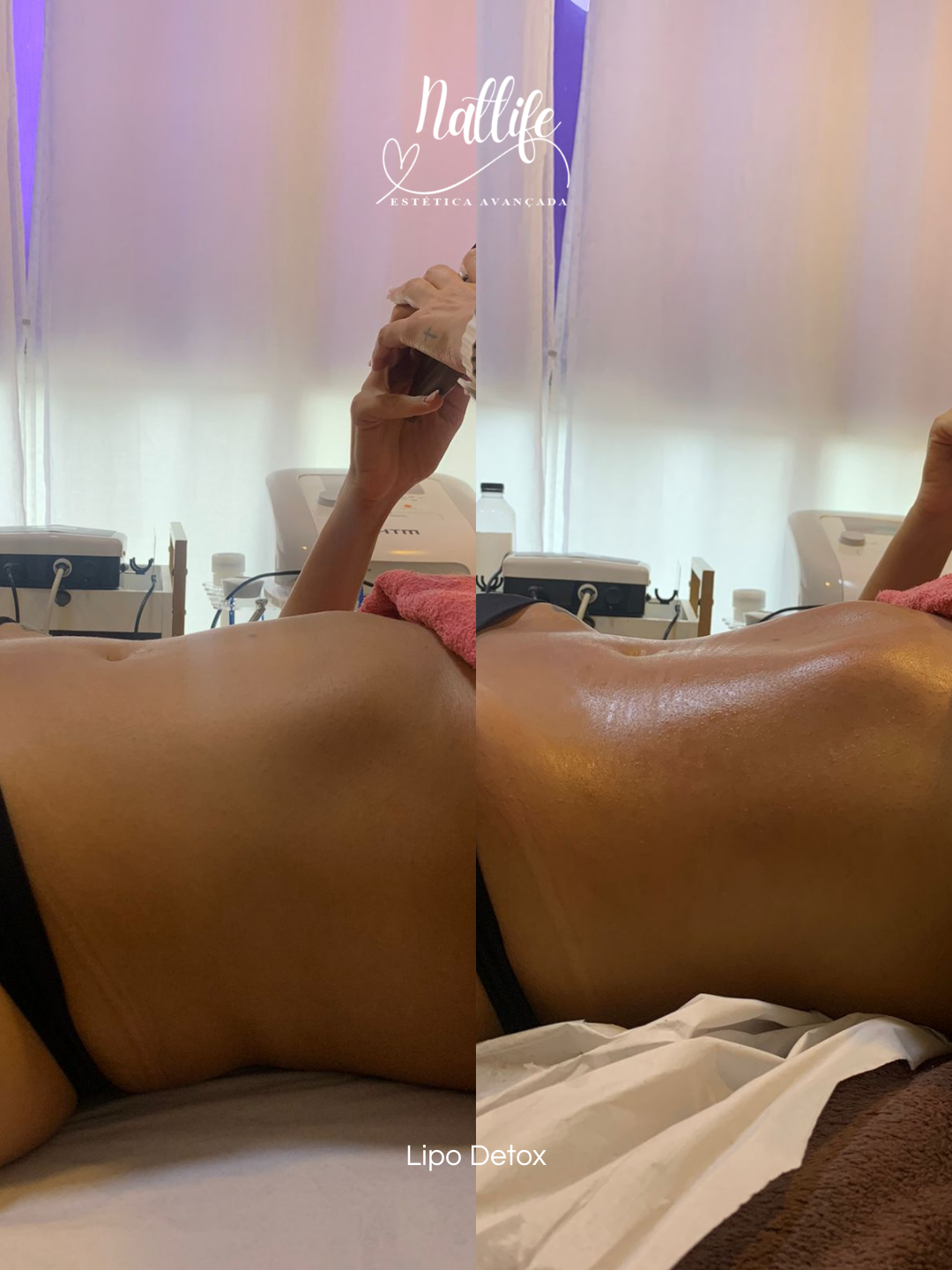 Lipo detox